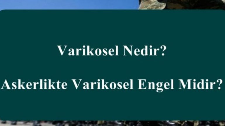 Varikosel Nedir? Askerlikte Varikosel Engel Midir?