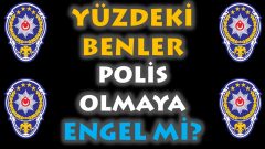 Yüzdeki Ben – Sivilce – Çil Bekçiliğe Engel Mi